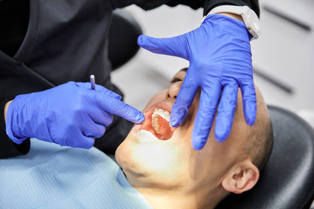 Best Emergency Broken Tooth Repair in Thermal, CA